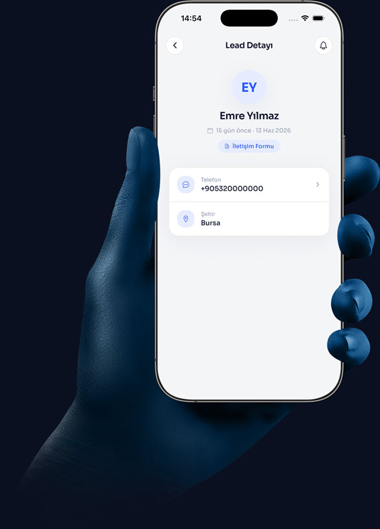 Newu App — Lead Detayı